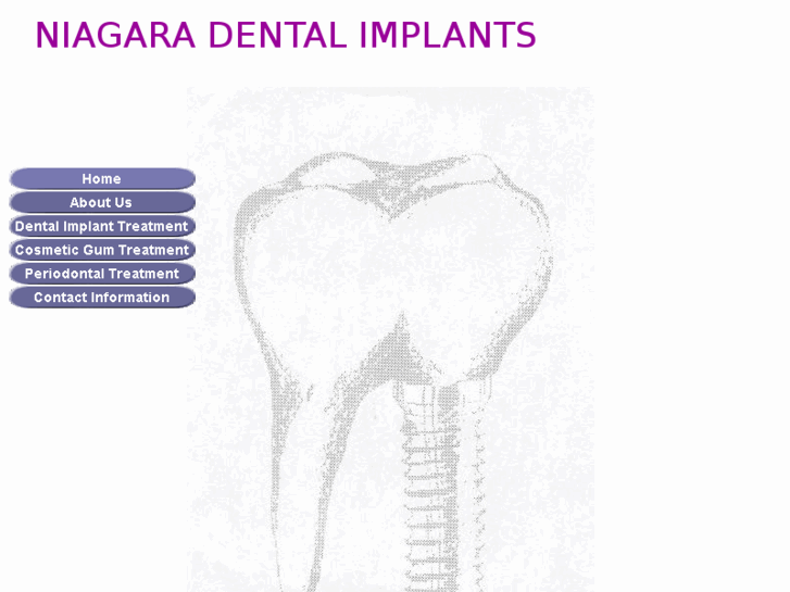 www.niagaradentalimplants.com