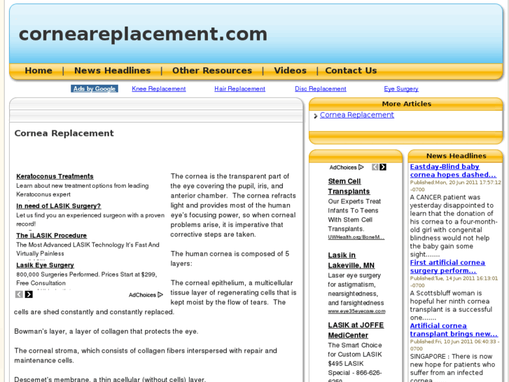 www.corneareplacement.com