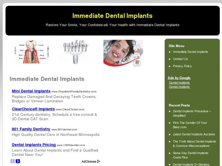 www.immediatedentalimplants.com