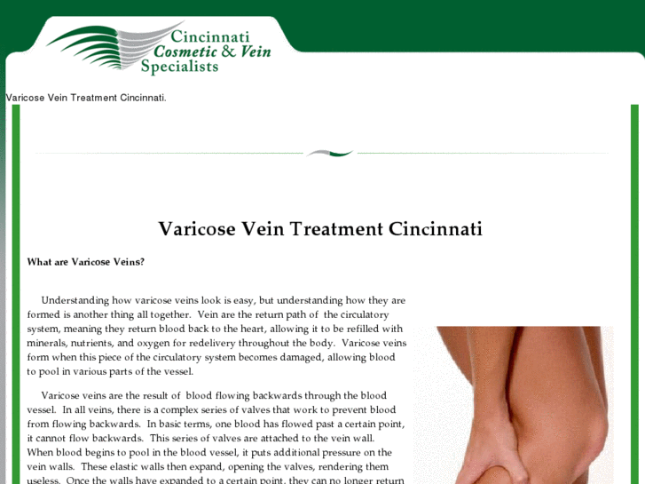 www.varicoseveintreatmentcincinnati.com