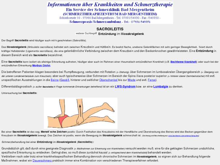 www.sacroileitis.de