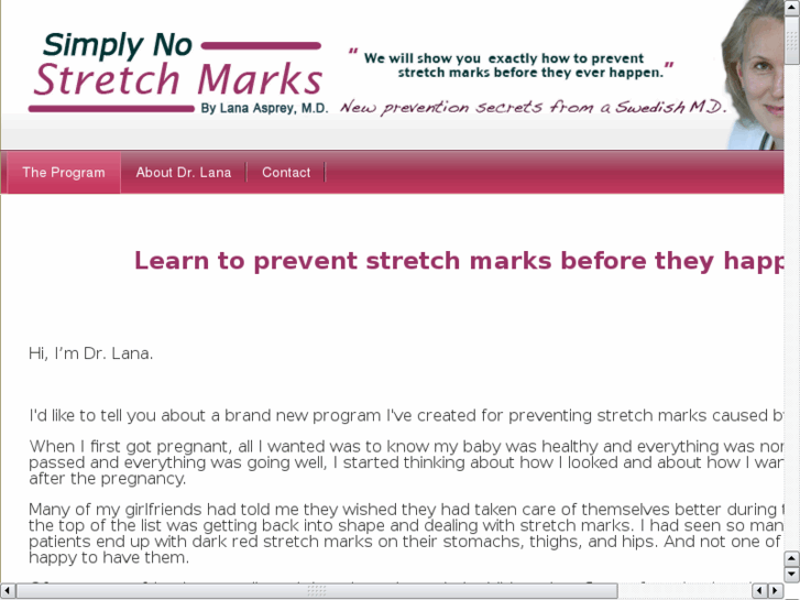 www.helpwithstretchmarks.com
