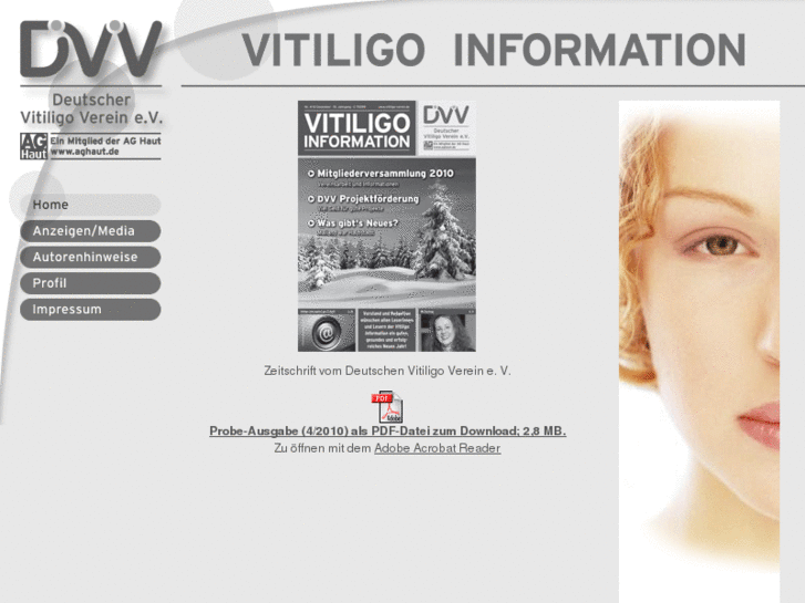 www.vitiligo-information.de