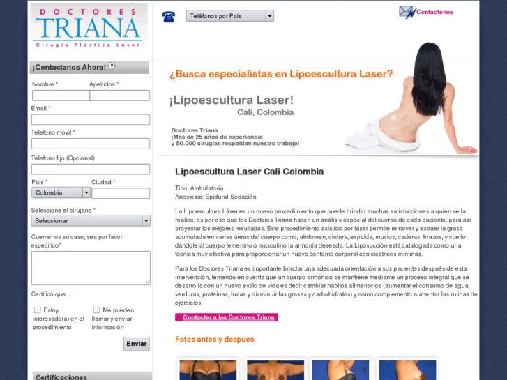 www.lipoesculturalasercali.com