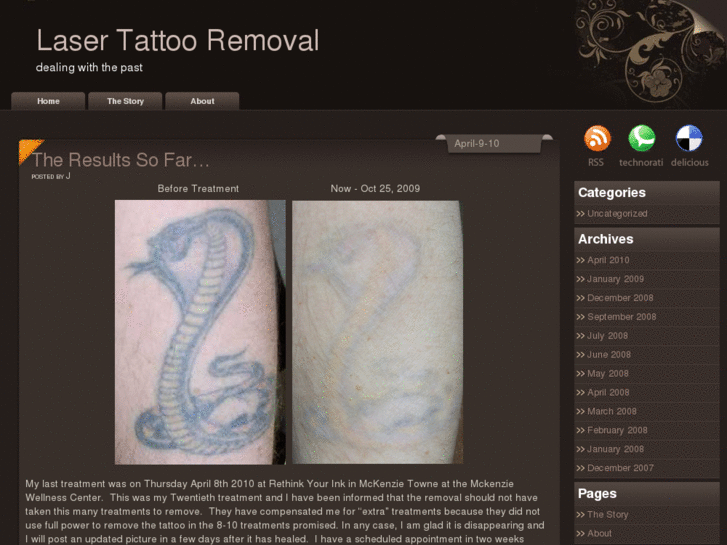 www.tattooremovalvancouver.com