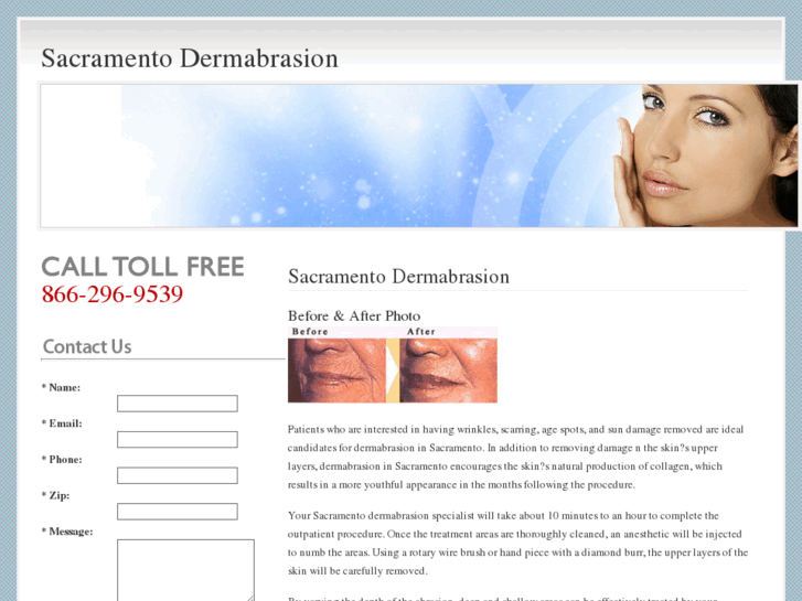 www.sacramentodermabrasion.com