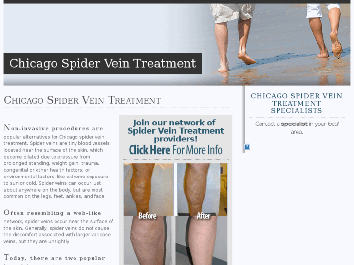 www.chicagospiderveintreatment.com