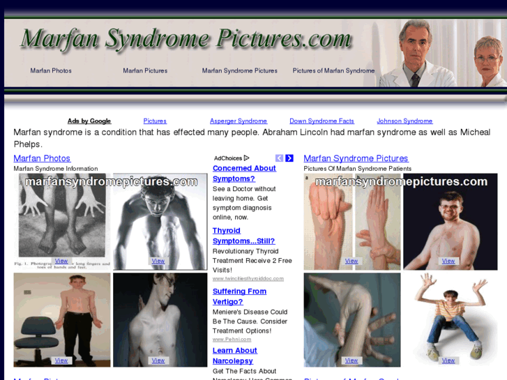 www.marfansyndromepictures.com