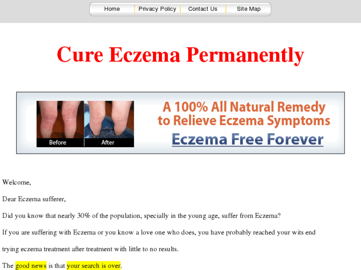 www.baby-eczema-treatment.com