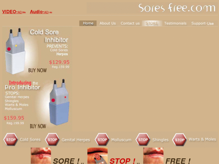 www.soresfree.com