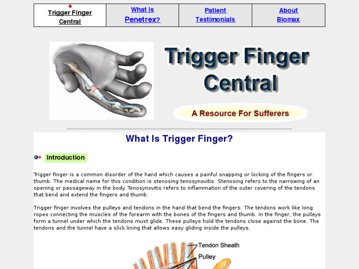 www.trigger-finger-central.com