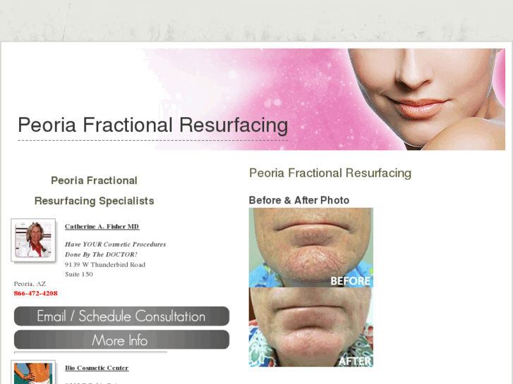 www.peoriafractionalresurfacing.com