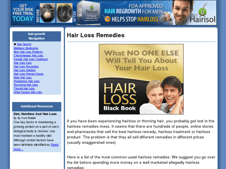 www.hairloss-remedies.info