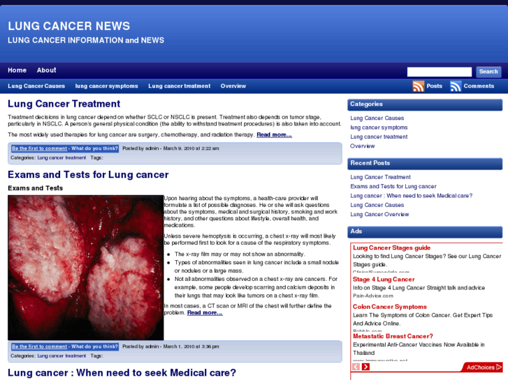 www.lungcancernews.net