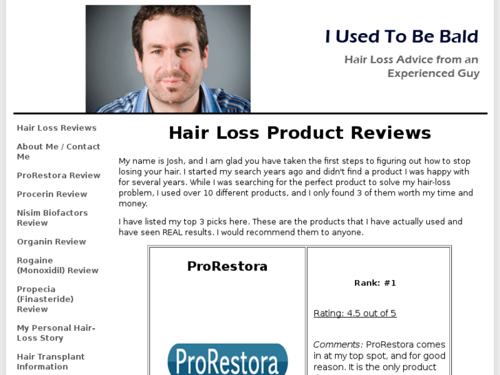 www.iusedtobebald.com