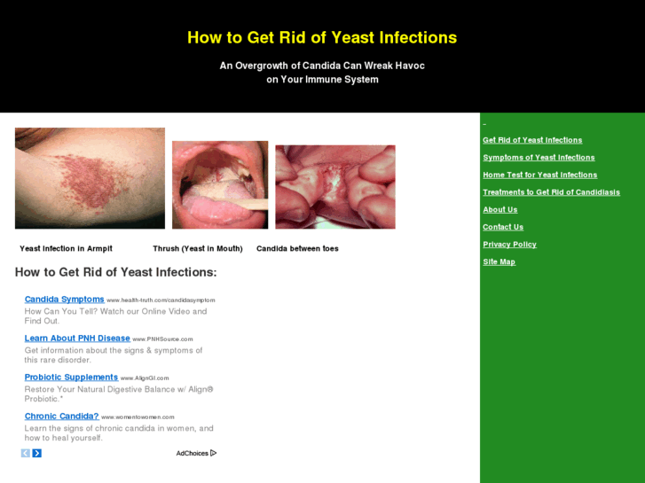 www.howtogetridofyeastinfections.com