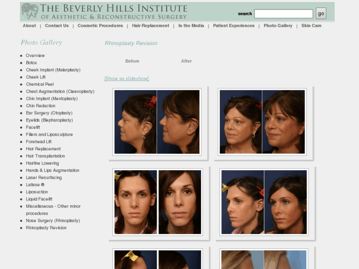 www.revisionrhinoplastybeverlyhills.com