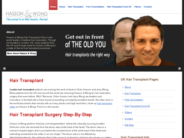 www.hairtransplant-london.co.uk