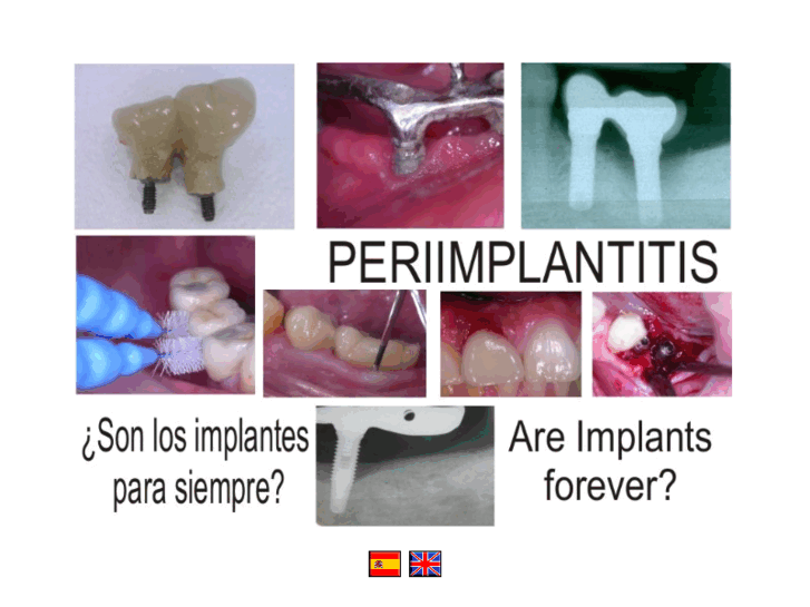 www.peri-implantology.com