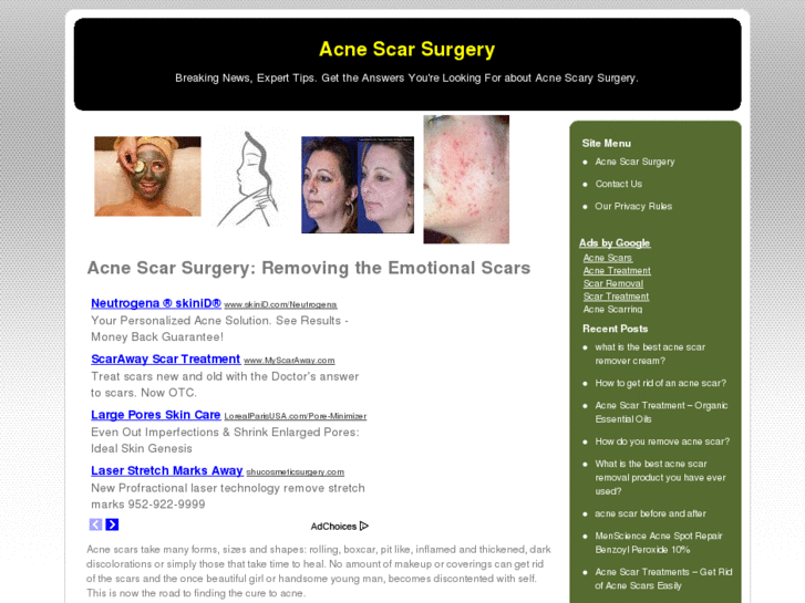 www.acnescarsurgery.net