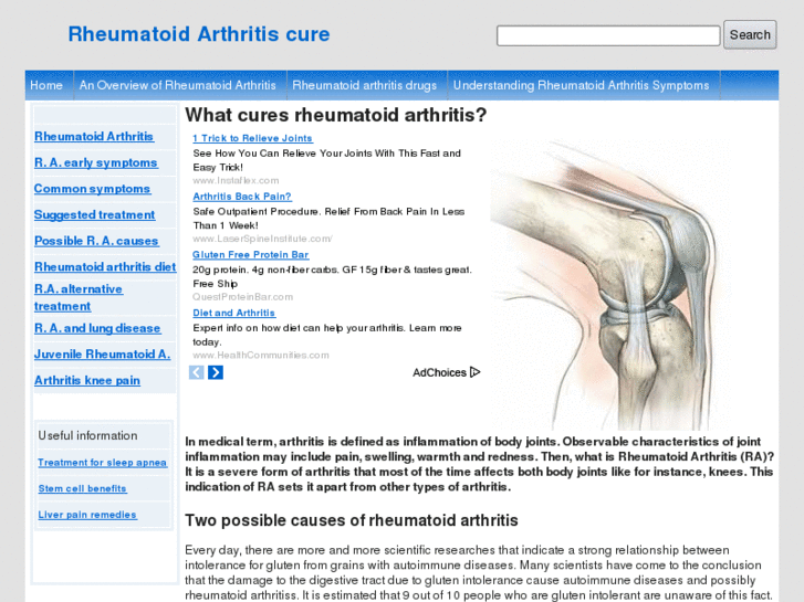 www.rheumatoidarthritiscure.info