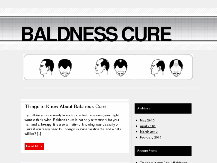 www.baldnesscuretips.com