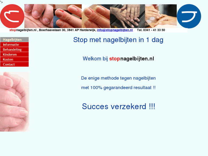 www.stopnagelbijten.com