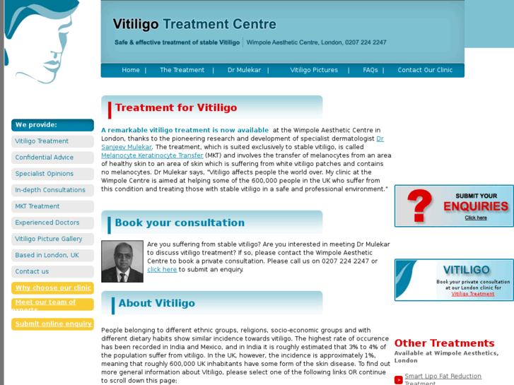 www.vitiligotreatments.co.uk