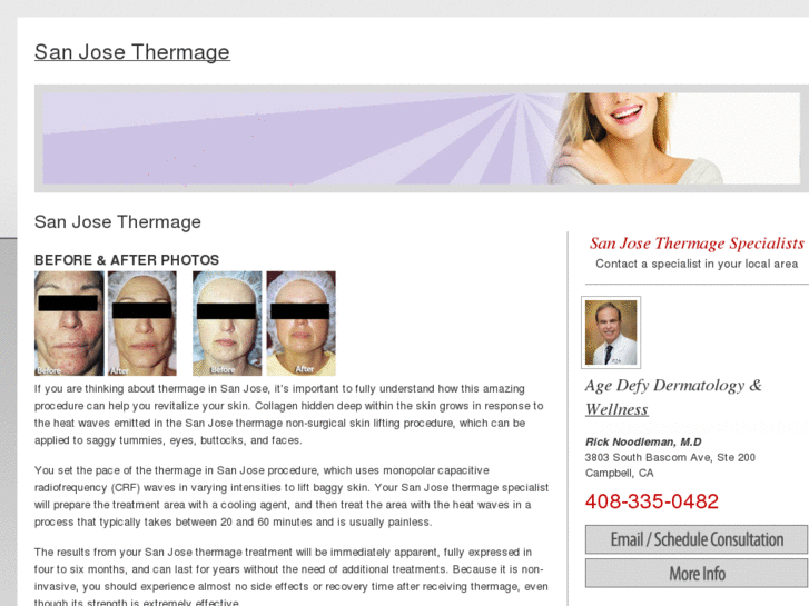 www.sanjosethermage.com