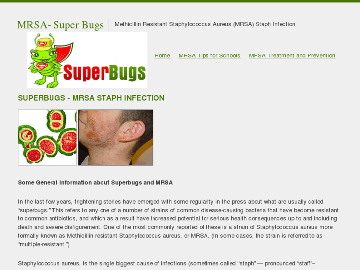 www.mrsa-super-bugs.com