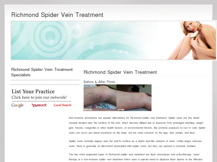 www.richmondspiderveintreatment.com