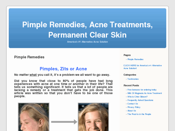 www.pimpleremedies.org