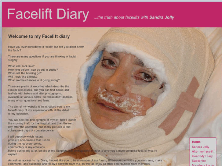 www.facelift-diary.com