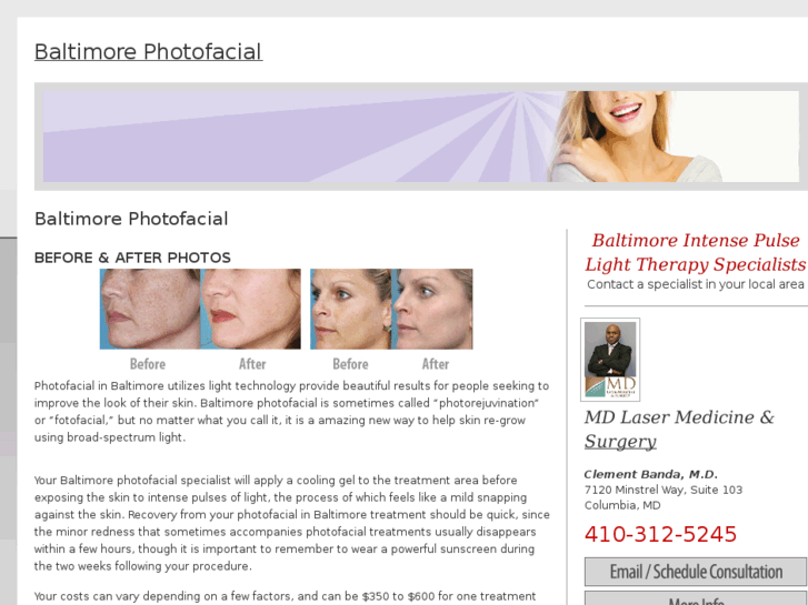 www.baltimorephotofacial.com