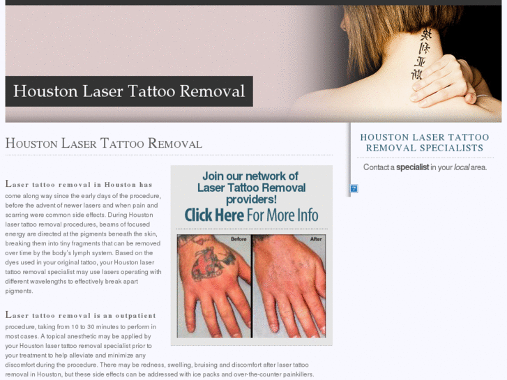 www.houstonlasertattooremoval.com