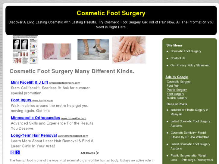 www.cosmeticfootsurgery.net