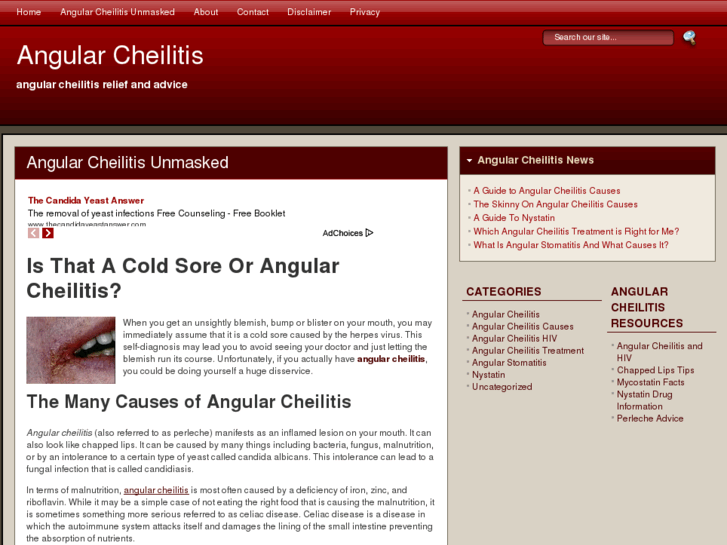 www.angularcheilitis.com