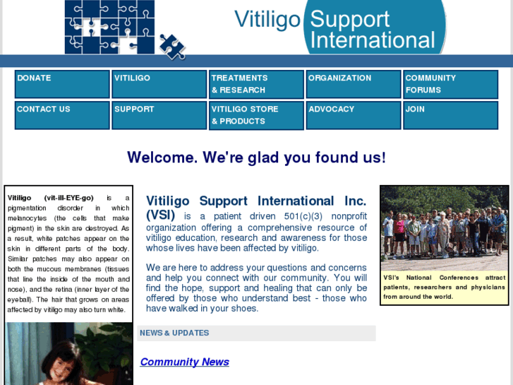 www.vitiligosupport.org