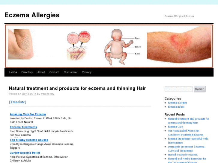 www.eczemaallergies.com