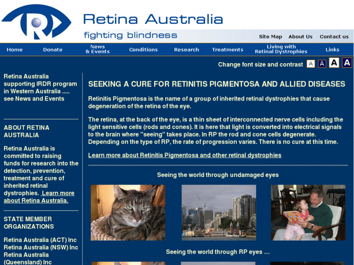 www.retinaaustralia.com.au