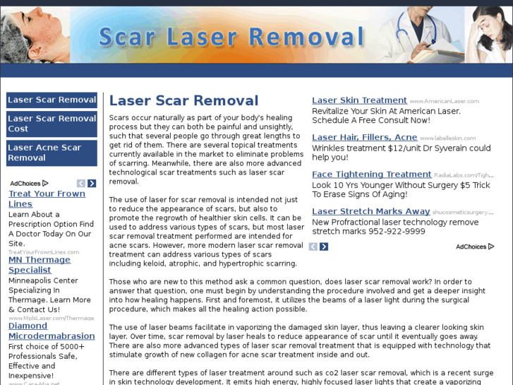 www.scarlaserremoval.com