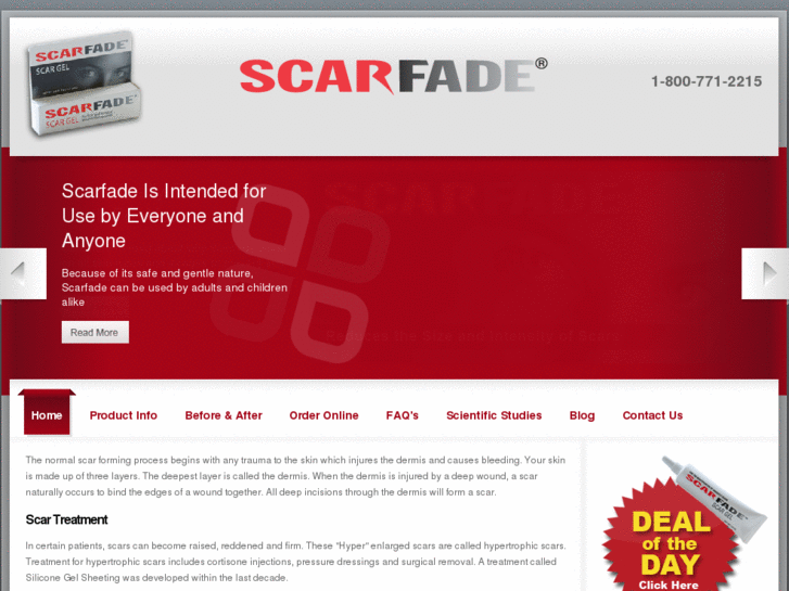 www.scarfade.com