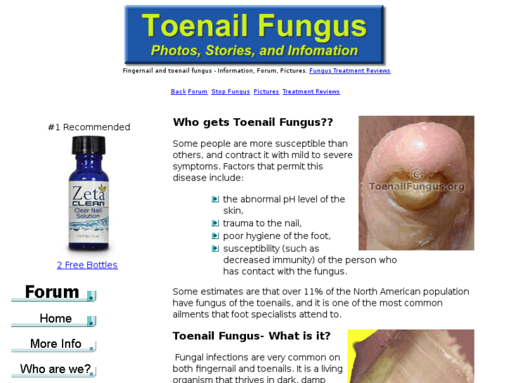 www.toenailfungus.org