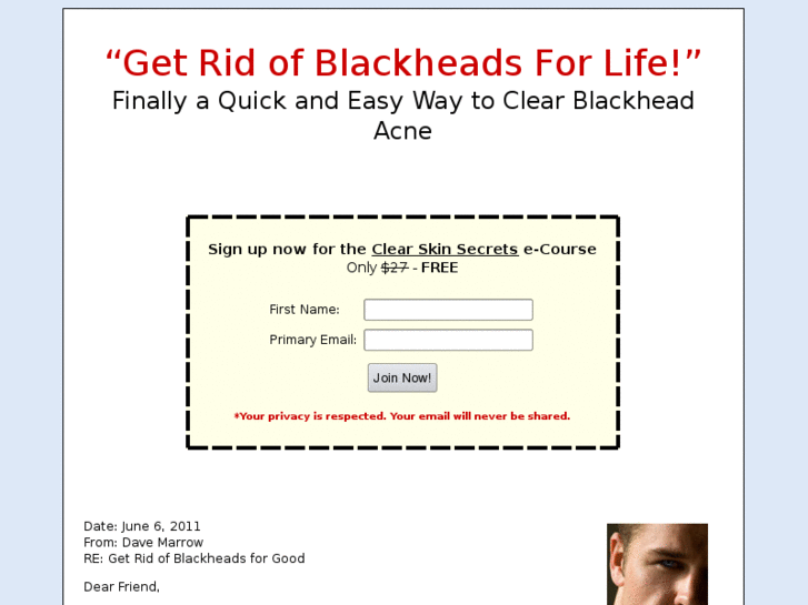 www.getridofblackheads.info