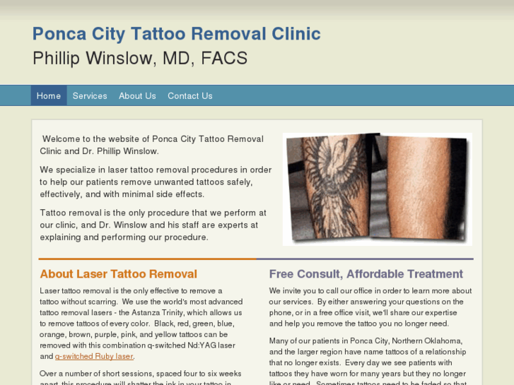 www.poncatattooremoval.com