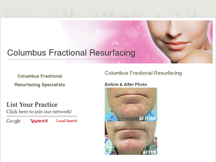 www.columbusfractionalresurfacing.com