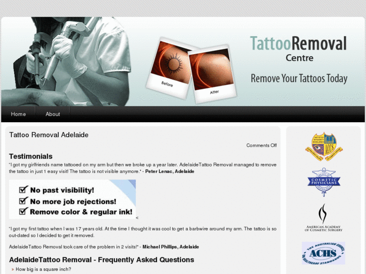 www.tattooremovaladelaide.com.au