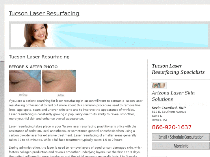 www.tucsonlaserresurfacing.com