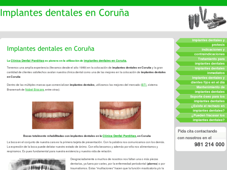 www.implantes-coruna.com