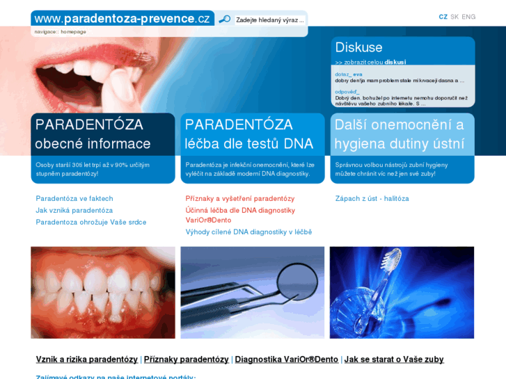 www.paradentoza-prevence.cz